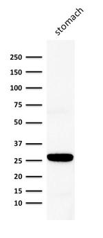 Connexin 32 (Gap Junction Protein) Antibody in Western Blot (WB)