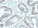 FOXP1 (Transcription Factor) Antibody in Immunohistochemistry (Paraffin) (IHC (P))