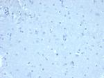 FOXP1 (Transcription Factor) Antibody in Immunohistochemistry (Paraffin) (IHC (P))