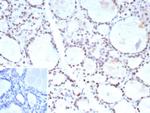 FOXP1 (Transcription Factor) Antibody in Immunohistochemistry (Paraffin) (IHC (P))