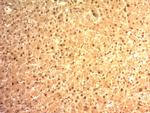 Glypican-3 (GPC3) (Hepatocellular Carcinoma Marker) Antibody in Immunohistochemistry (Paraffin) (IHC (P))