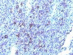 Glypican-3 (GPC3) (Hepatocellular Carcinoma Marker) Antibody in Immunohistochemistry (Paraffin) (IHC (P))