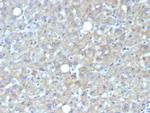 Glypican-3 (GPC3) (Hepatocellular Carcinoma Marker) Antibody in Immunohistochemistry (Paraffin) (IHC (P))