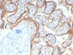 Glypican-3 (GPC3) (Hepatocellular Carcinoma Marker) Antibody in Immunohistochemistry (Paraffin) (IHC (P))