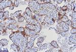 Glypican-3 (GPC3) (Hepatocellular Carcinoma Marker) Antibody in Immunohistochemistry (Paraffin) (IHC (P))