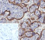 Glypican-3 (GPC3) (Hepatocellular Carcinoma Marker) Antibody in Immunohistochemistry (Paraffin) (IHC (P))