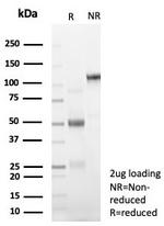 Glypican-3 (GPC3) (Hepatocellular Carcinoma Marker) Antibody in SDS-PAGE (SDS-PAGE)