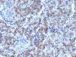 Glypican-3 (GPC3) Antibody in Immunohistochemistry (Paraffin) (IHC (P))