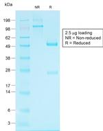 Glypican-3 (GPC3) Antibody in SDS-PAGE (SDS-PAGE)