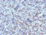 Glypican-3 (GPC3) (Hepatocellular Carcinoma Marker) Antibody in Immunohistochemistry (Paraffin) (IHC (P))