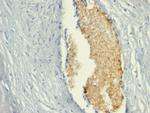 AMP Deaminase, Isoform E (AMPD3) Antibody in Immunohistochemistry (Paraffin) (IHC (P))