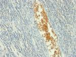 AMP Deaminase, Isoform E (AMPD3) Antibody in Immunohistochemistry (Paraffin) (IHC (P))