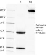 AMP Deaminase, Isoform E (AMPD3) Antibody in SDS-PAGE (SDS-PAGE)