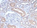 GCLM (DNA Mismatch Repair Protein) Antibody in Immunohistochemistry (Paraffin) (IHC (P))