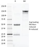 TOX3/TNRC9 Antibody in SDS-PAGE (SDS-PAGE)