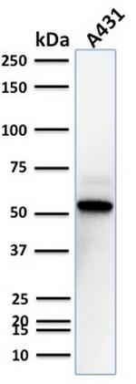 TOX3/TNRC9 Antibody in Western Blot (WB)