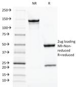 TOX3/TNRC9 Antibody in SDS-PAGE (SDS-PAGE)