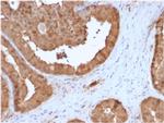 Glyoxalase 1 (GLO1) Antibody in Immunohistochemistry (Paraffin) (IHC (P))