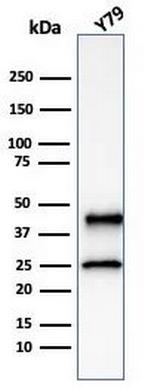 Glutamine Synthetase/GLUL Antibody in Western Blot (WB)