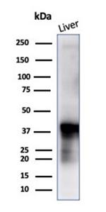 Glutamine Synthetase/GLUL Antibody in Western Blot (WB)