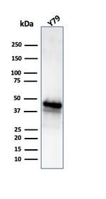 Glutamine Synthetase/GLUL Antibody in Western Blot (WB)