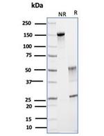 Glutamine Synthetase/GLUL Antibody in Immunoelectrophoresis (IE)