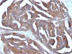 GnRH-Receptor/LH-RH Receptor Antibody in Immunohistochemistry (Paraffin) (IHC (P))