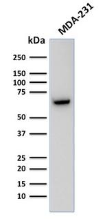 GnRH-Receptor/LH-RH Receptor Antibody in Western Blot (WB)