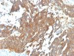 GnRH-Receptor/LH-RH Receptor Antibody in Immunohistochemistry (Paraffin) (IHC (P))