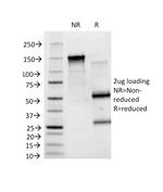 Blood Group Antigen B (CD173) Antibody in SDS-PAGE (SDS-PAGE)