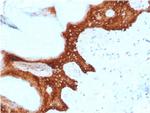 14-3-3 Sigma/Stratifin Antibody in Immunohistochemistry (Paraffin) (IHC (P))