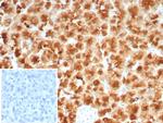 GP2 (Glycoprotein 2)/ZAP75 Antibody in Immunohistochemistry (Paraffin) (IHC (P))