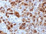 GP2 (Glycoprotein 2)/ZAP75 Antibody in Immunohistochemistry (Paraffin) (IHC (P))