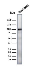 GP2 (Glycoprotein 2)/ZAP75 Antibody in Western Blot (WB)