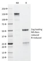 GP2 (Glycoprotein 2)/ZAP75 Antibody in SDS-PAGE (SDS-PAGE)