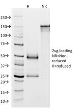 GP2 (Glycoprotein 2)/ZAP75 Antibody in SDS-PAGE (SDS-PAGE)