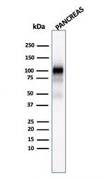 GP2 (Glycoprotein 2)/ZAP75 Antibody in Western Blot (WB)