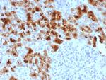 GP2 (Glycoprotein 2)/ZAP75 Antibody in Immunohistochemistry (Paraffin) (IHC (P))