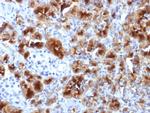 GP2 (Glycoprotein 2)/ZAP75 Antibody in Immunohistochemistry (Paraffin) (IHC (P))