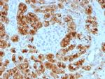 GP2 (Glycoprotein 2)/ZAP75 Antibody in Immunohistochemistry (Paraffin) (IHC (P))