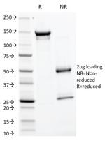 GP2 (Glycoprotein 2)/ZAP75 Antibody in SDS-PAGE (SDS-PAGE)