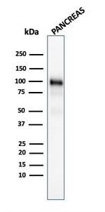 GP2 (Glycoprotein 2)/ZAP75 Antibody in Western Blot (WB)