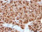 GP2 (Glycoprotein 2)/ZAP75 Antibody in Immunohistochemistry (Paraffin) (IHC (P))