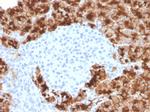 GP2 (Glycoprotein 2)/ZAP75 Antibody in Immunohistochemistry (Paraffin) (IHC (P))