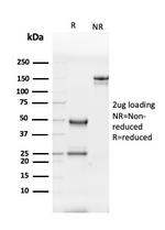 GP2 (Glycoprotein 2)/ZAP75 Antibody in SDS-PAGE (SDS-PAGE)