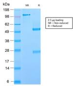 GP2 (Glycoprotein 2)/ZAP75 Antibody in SDS-PAGE (SDS-PAGE)