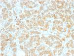 GP2 (Glycoprotein 2)/ZAP75 Antibody in Immunohistochemistry (Paraffin) (IHC (P))