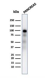 GP2 (Glycoprotein 2)/ZAP75 Antibody in Western Blot (WB)