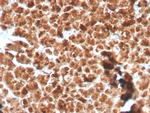 GP2 (Glycoprotein 2)/ZAP75 Antibody in Immunohistochemistry (Paraffin) (IHC (P))