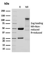 GP2 (Glycoprotein 2)/ZAP75 Antibody in SDS-PAGE (SDS-PAGE)